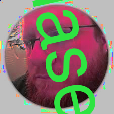 laser